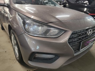 Hyundai Solaris установка линз Statlight A6, ангельские глазки, светодиодная полоска ДХО-поворот (3)